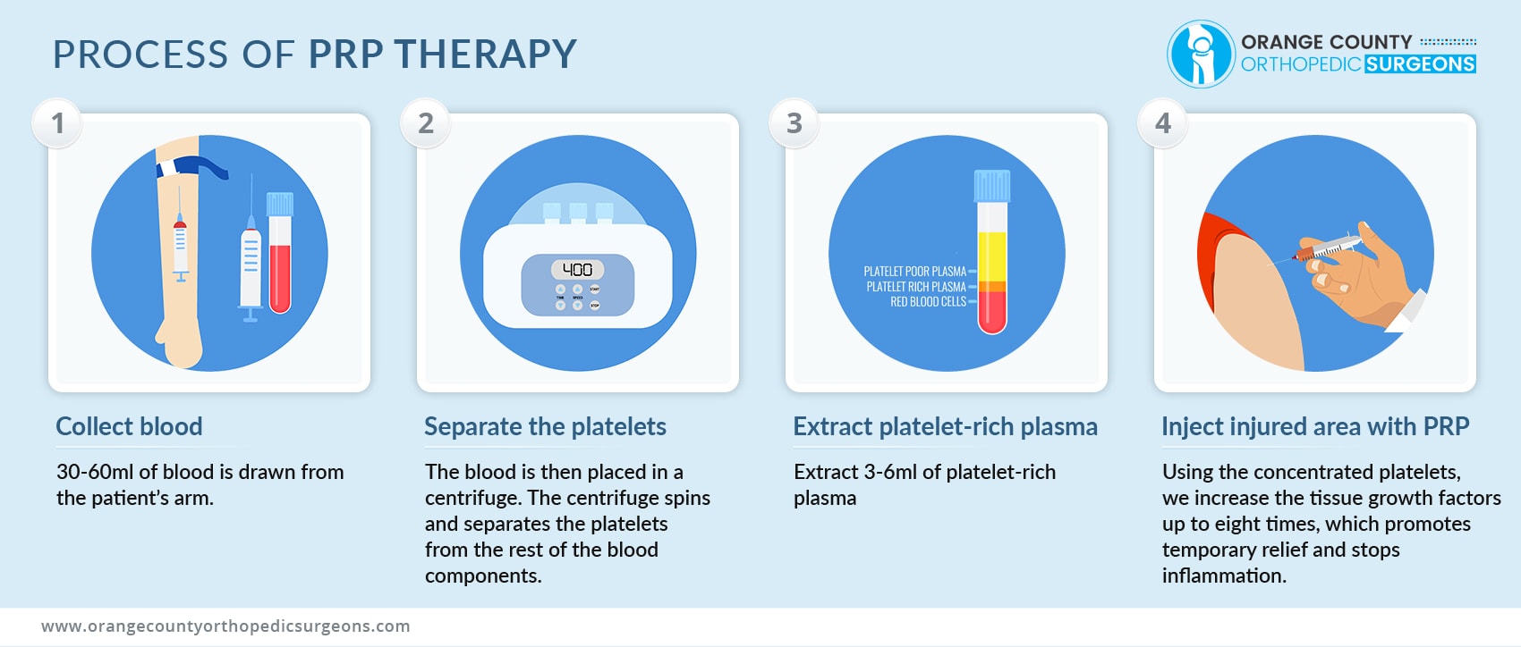 Process of PRP Therapy OC Orthopedic Surgeons min - Infographics